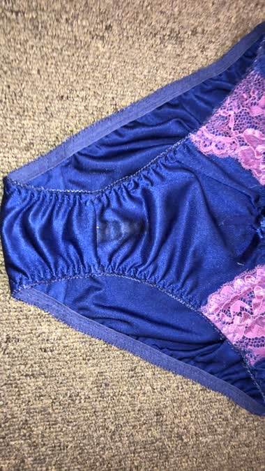 シミが出来てます