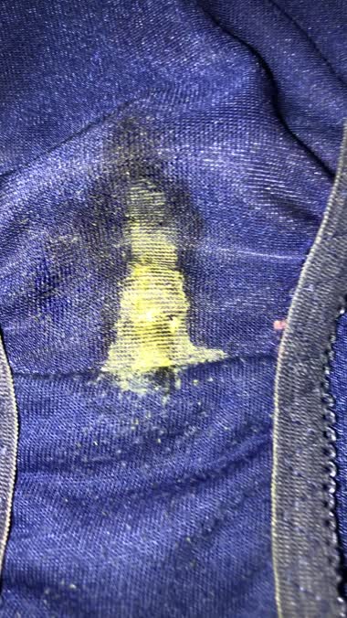 クロッチアップ