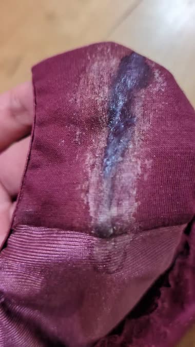 看護師妻の染み