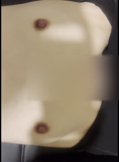 敏感