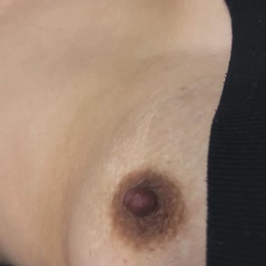 医者に見られた乳首